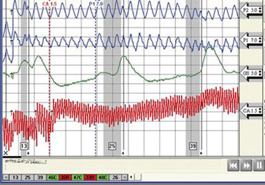 price quote for a polygraph test in Los Angeles